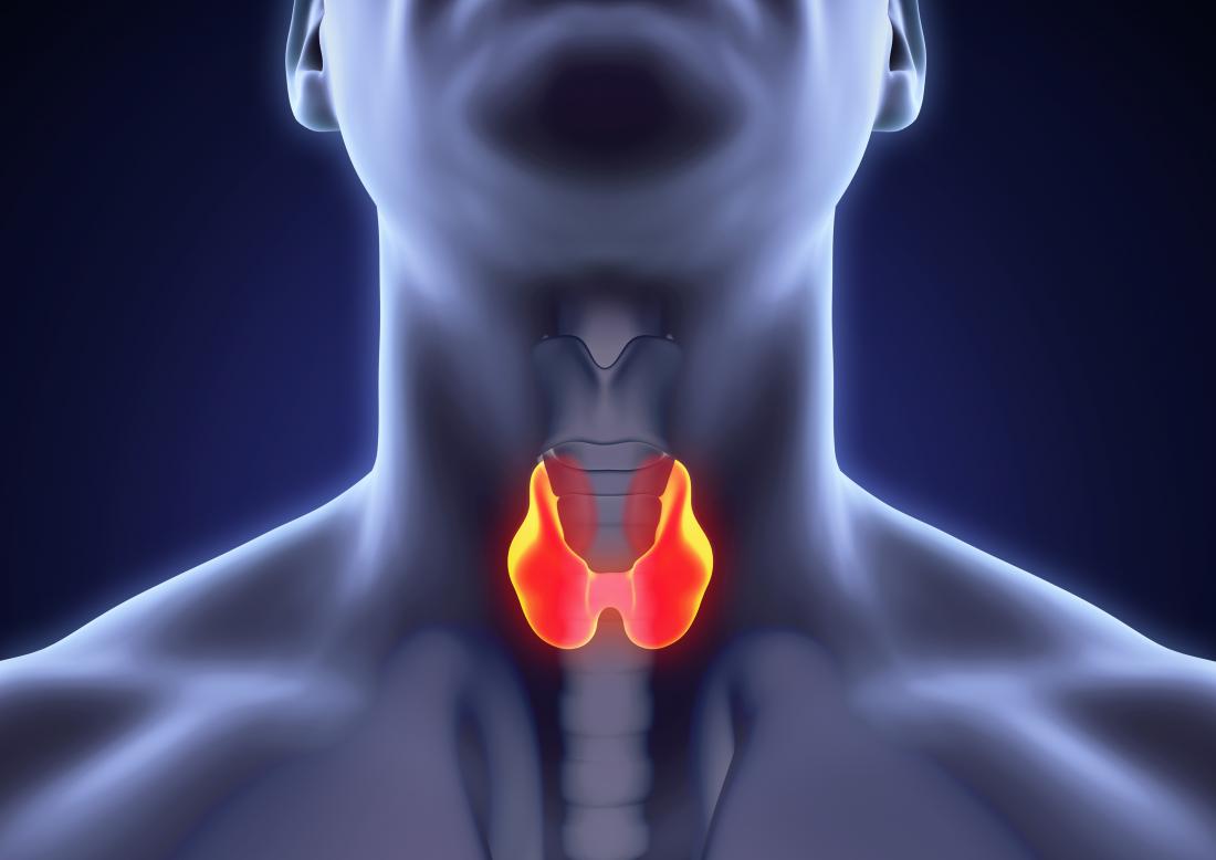 Early signs of medullary thyroid cancer and common symptoms