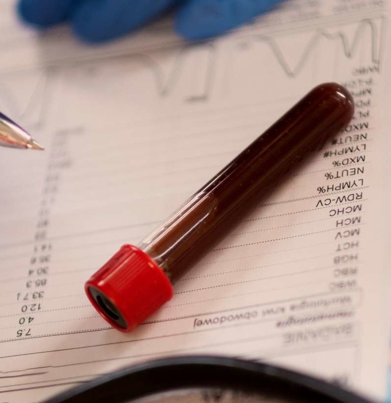 How long does it take to receive blood test results? A guide