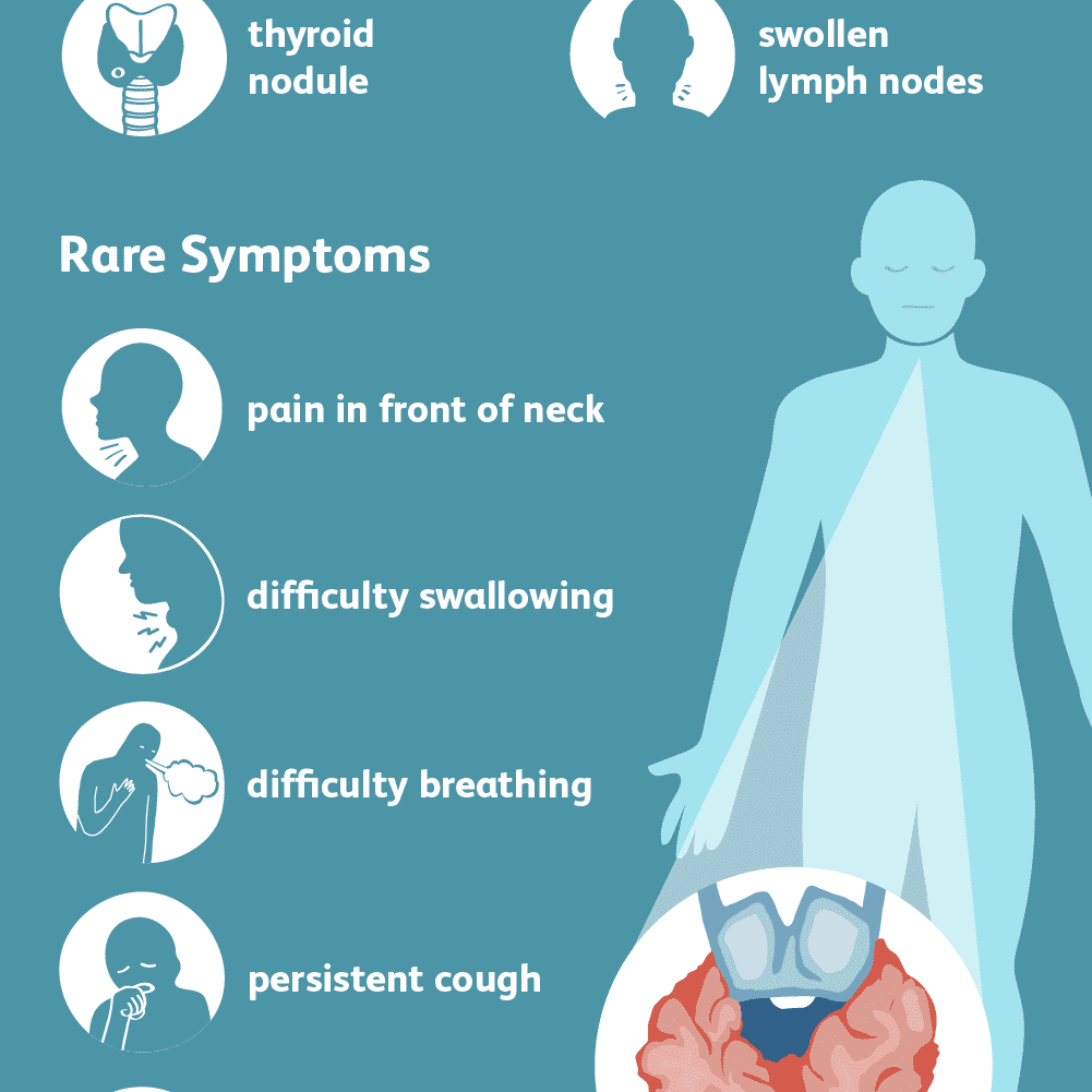 View 9 Stage 2 Thyroid Cancer Symptoms